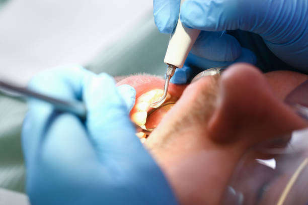 Best Walk-In Emergency Dental Services in Sandy Springs, SC