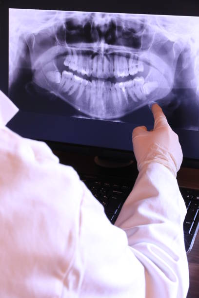 Best Urgent Dental Care for Toothaches in Sandy Springs, SC